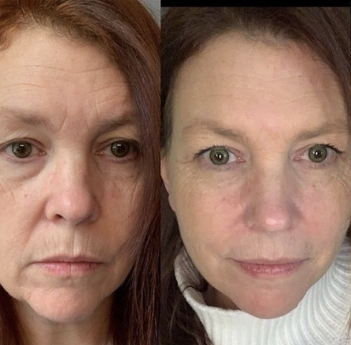 Vivace Plastic Surgery and Medical Spa in Norwich, CT