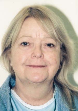 Facelift Before and After Pictures Norwich, CT