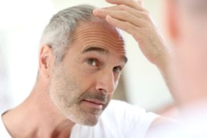 Hair Restoration in Norwich, CT