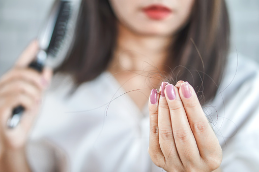 Norwich Residents Ask: What Causes Women’s Hair to Fall Out?
