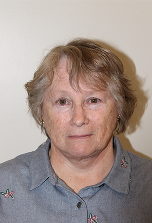Facelift Before and After Pictures Norwich, CT