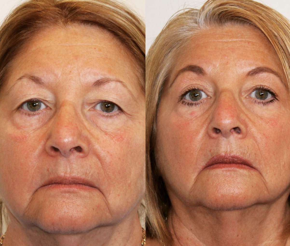 Plastic Surgery and Medical Spa in Norwich, CT