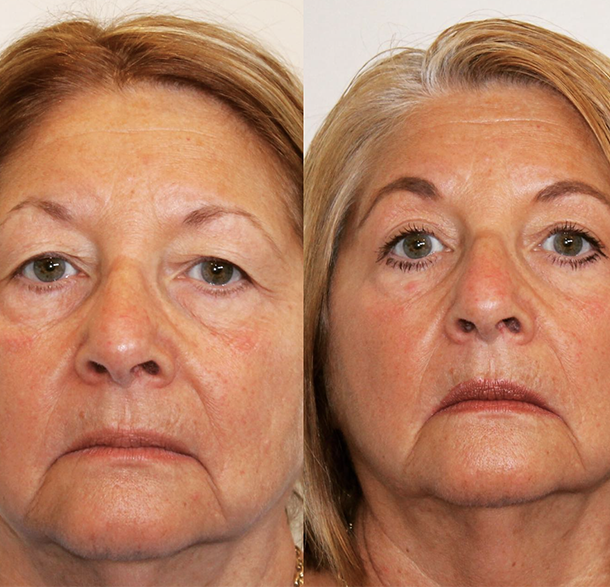 Plastic Surgery and Medical Spa in Norwich, CT