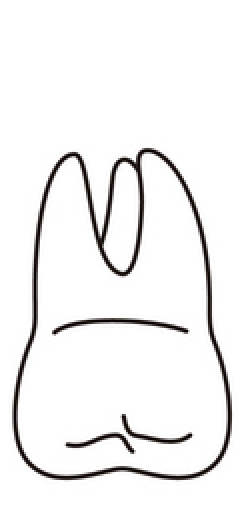 tooth 15